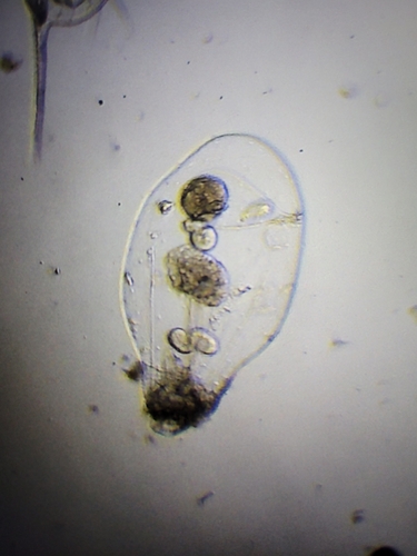 Asplanchna