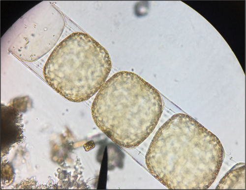 Melosira (marine Phytoplankton Of The Grand Strand Region Of Sc 