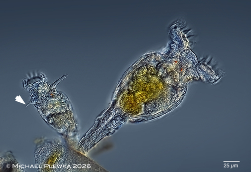 Philodina megalotrocha