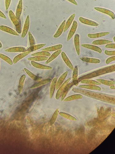 Hymenoscyphus