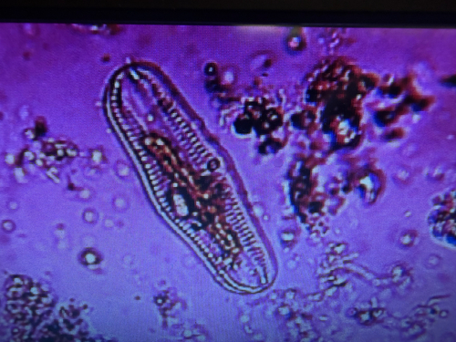 Epithemia gibba