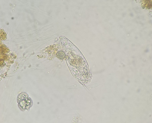 Trichocerca similis