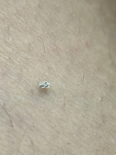 Eastern Sycamore Lace Bug