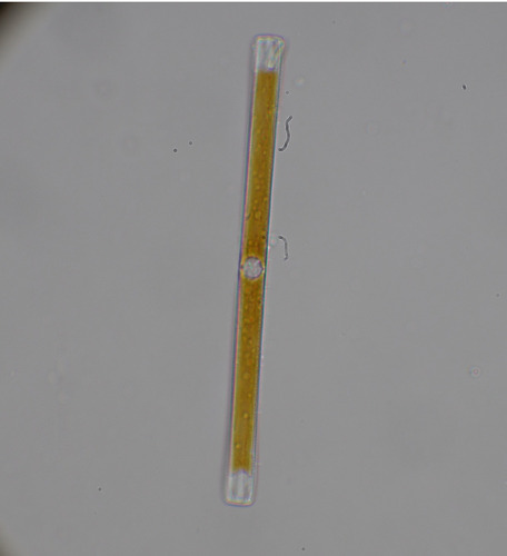 Ulnaria ulna