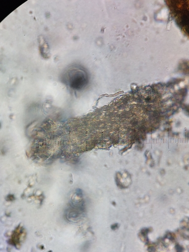 Bdelloidea