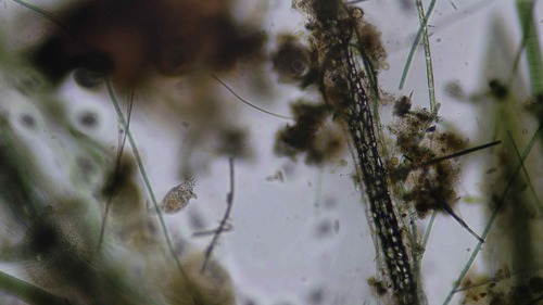 Philodina megalotrocha